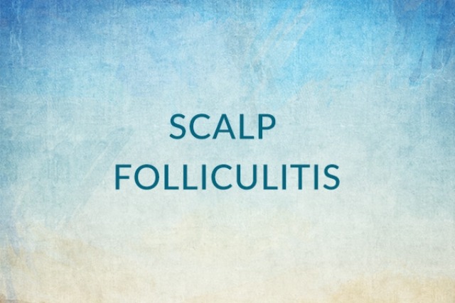 folliculitis after hair transplant